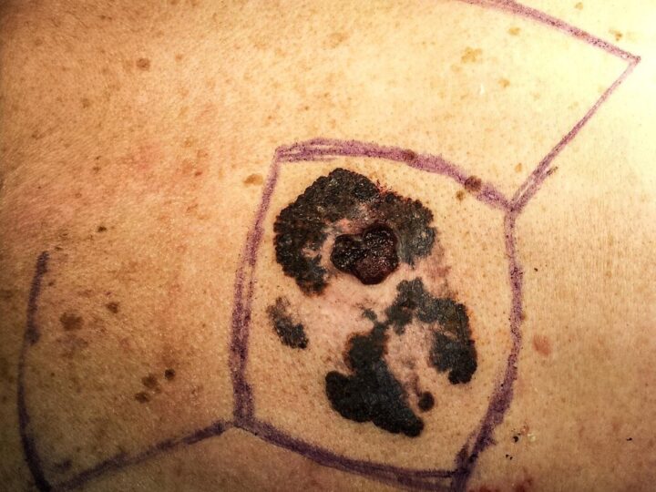 Mole spożywcze – jak wyglądają i jak je zwalczać?