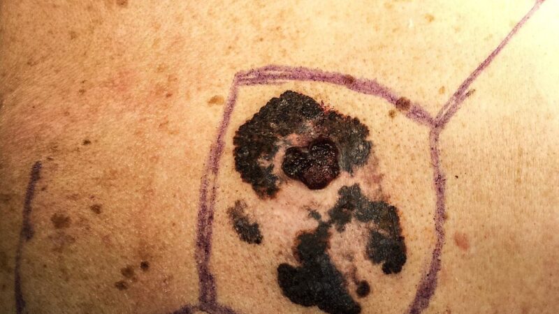 Mole spożywcze – jak wyglądają i jak je zwalczać?