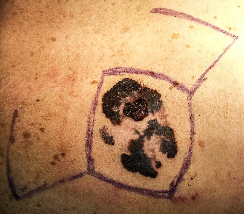 Mole spożywcze – jak wyglądają i jak je zwalczać?